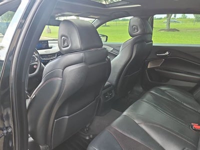 2021 Acura TLX A-SPEC Package